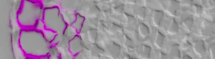 Cellulose-directed CBM9-2:FITC (purple) binding to epidermis & collenchyma inner cell walls in TS celery petiole / DIC image