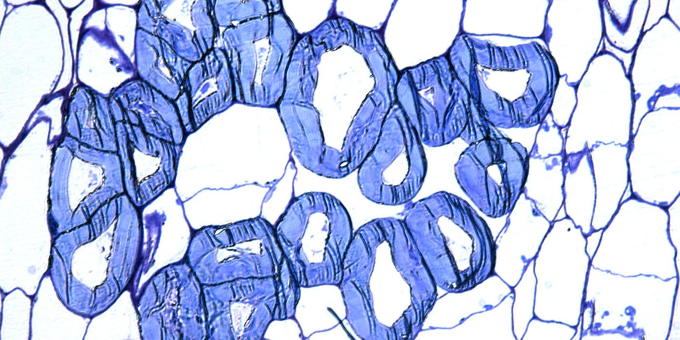 Image of primary and secondary cell walls